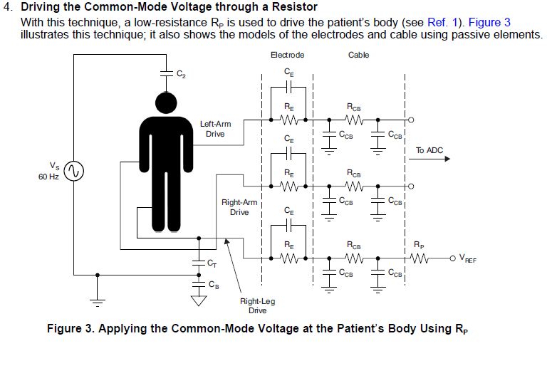 Acquired signals provided by the patient simulator PatSim200: a) normal