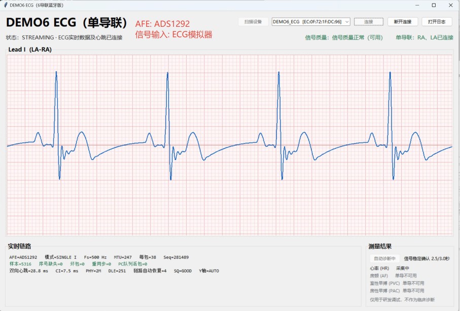 ECG01.jpg
