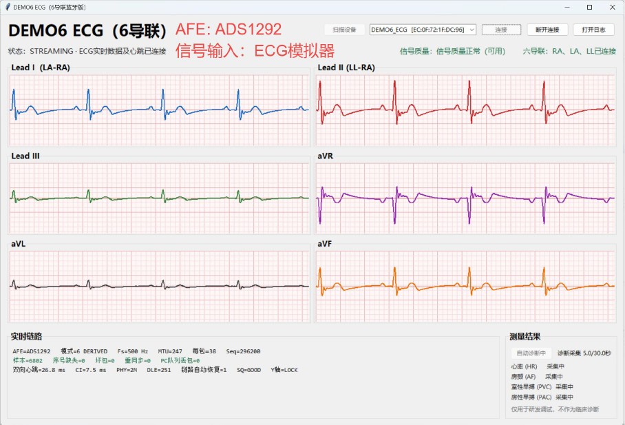 ECG03.jpg