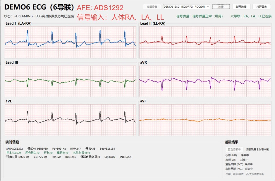 ECG04.jpg
